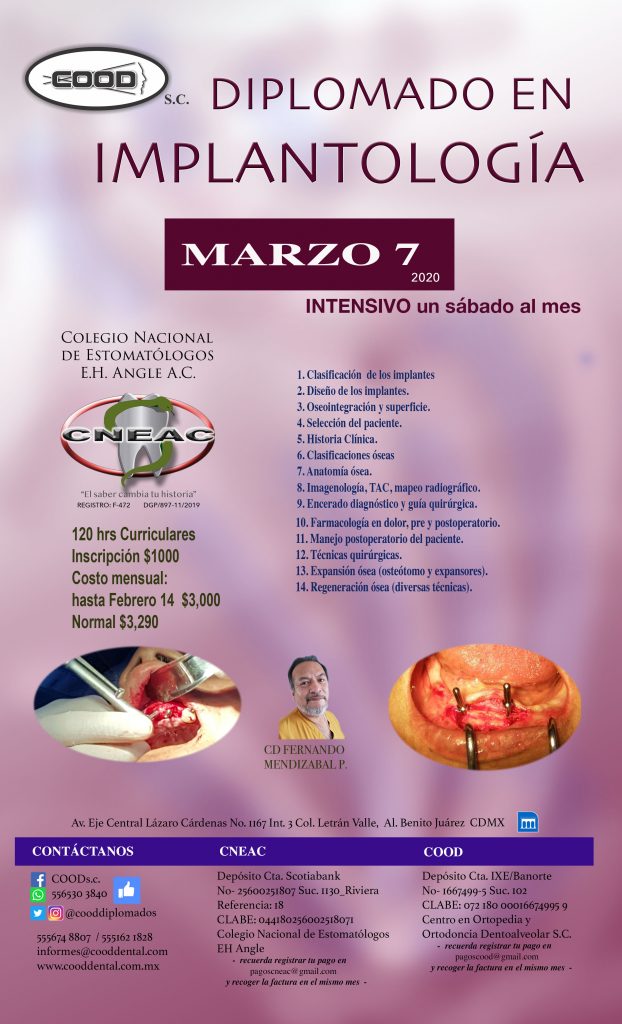 IMPLANTO MARZO 7 IMPLANTO MARZO 7